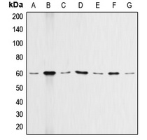AKT Rabbit Polyclonal Antibody