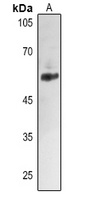 ALDH2 Rabbit Polyclonal Antibody