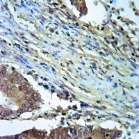 ALDH2 Rabbit Polyclonal Antibody