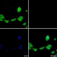 ALDH2 Rabbit Polyclonal Antibody