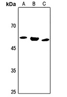 ALDH1B1 Rabbit Polyclonal Antibody