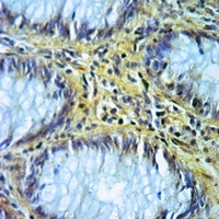 ALDH1B1 Rabbit Polyclonal Antibody