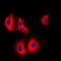 ALDOA Rabbit Polyclonal Antibody