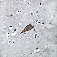 CD13 Rabbit Polyclonal Antibody