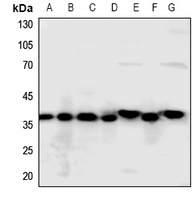 Annexin A2 Rabbit Polyclonal Antibody