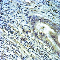 Annexin A2 Rabbit Polyclonal Antibody