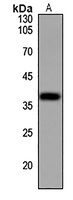 Annexin A3 Rabbit Polyclonal Antibody