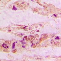 Annexin A3 Rabbit Polyclonal Antibody