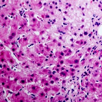 Annexin A6 Rabbit Polyclonal Antibody