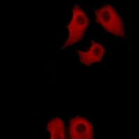 Annexin A6 Rabbit Polyclonal Antibody