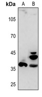 APAF-1-ALT Rabbit Polyclonal Antibody
