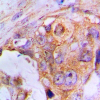 APAF-1-ALT Rabbit Polyclonal Antibody