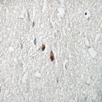 (Phospho-S2054) Rabbit Polyclonal Antibody (APC)