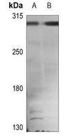 APC Rabbit Polyclonal Antibody (APC)