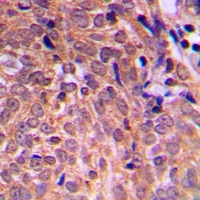 APC Rabbit Polyclonal Antibody (APC)