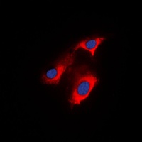 APC Rabbit Polyclonal Antibody (APC)