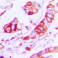 APLP2 Rabbit Polyclonal Antibody