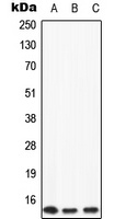 Apolipoprotein C2 Rabbit Polyclonal Antibody