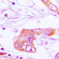 Apolipoprotein E Rabbit Polyclonal Antibody