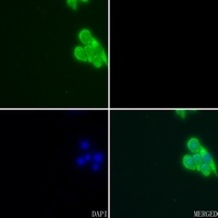 Apolipoprotein E Rabbit Polyclonal Antibody