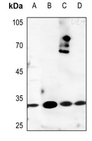 Kallikrein 3 Rabbit Polyclonal Antibody