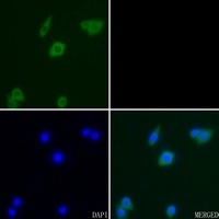 CD95 Antibody