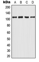 Androgen Receptor (Phospho-Y363) Rabbit Polyclonal Antibody