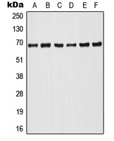 A-RAF (Phospho-Y302) Rabbit Polyclonal Antibody
