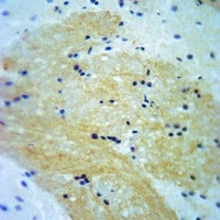 A-RAF (Phospho-Y302) Rabbit Polyclonal Antibody