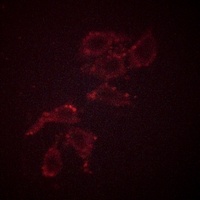 A-RAF (Phospho-Y302) Rabbit Polyclonal Antibody