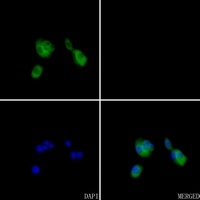 ARF6 Rabbit Polyclonal Antibody