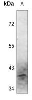 Arginase 1 Rabbit Polyclonal Antibody