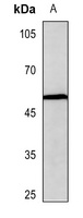 Beta-arrestin-1 (Phospho-S412) Rabbit Polyclonal Antibody