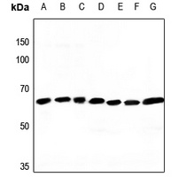 ATP5A1 Rabbit Polyclonal Antibody