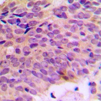 ATP5A1 Rabbit Polyclonal Antibody