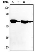 ATP6V1B1 Rabbit Polyclonal Antibody