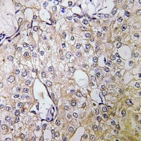 ATP6V1B1 Rabbit Polyclonal Antibody