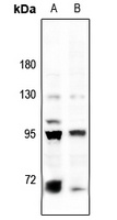 BACH1 Rabbit Polyclonal Antibody