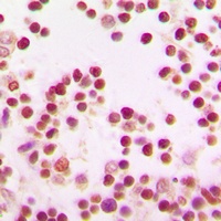 BACH1 Rabbit Polyclonal Antibody