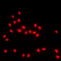 BACH1 Rabbit Polyclonal Antibody
