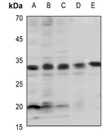 BCL2 (Phospho-T69) Antibody