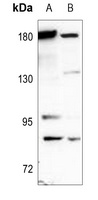 CD66a/e Rabbit Polyclonal Antibody
