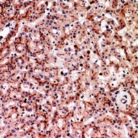 CD66a/e Rabbit Polyclonal Antibody