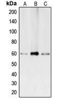 BMP2 Rabbit Polyclonal Antibody