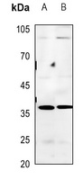 BNIP2 Antibody