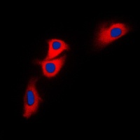BNIP2 Antibody