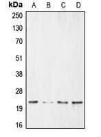 BNIP3 Rabbit Polyclonal Antibody