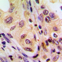 B-RAF Rabbit Polyclonal Antibody