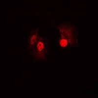 B-RAF Rabbit Polyclonal Antibody