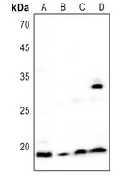 BST2 Rabbit Polyclonal Antibody